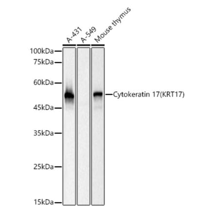 Western Blot - Anti-Cytokeratin 17 Antibody [ARC0271] (A307949) - Antibodies.com