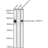 Western Blot - Anti-Cytokeratin 17 Antibody [ARC0271] (A307949) - Antibodies.com