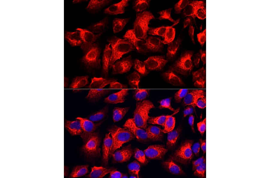 Immunofluorescence - Anti-Cytokeratin 17 Antibody [ARC0271] (A307949) - Antibodies.com