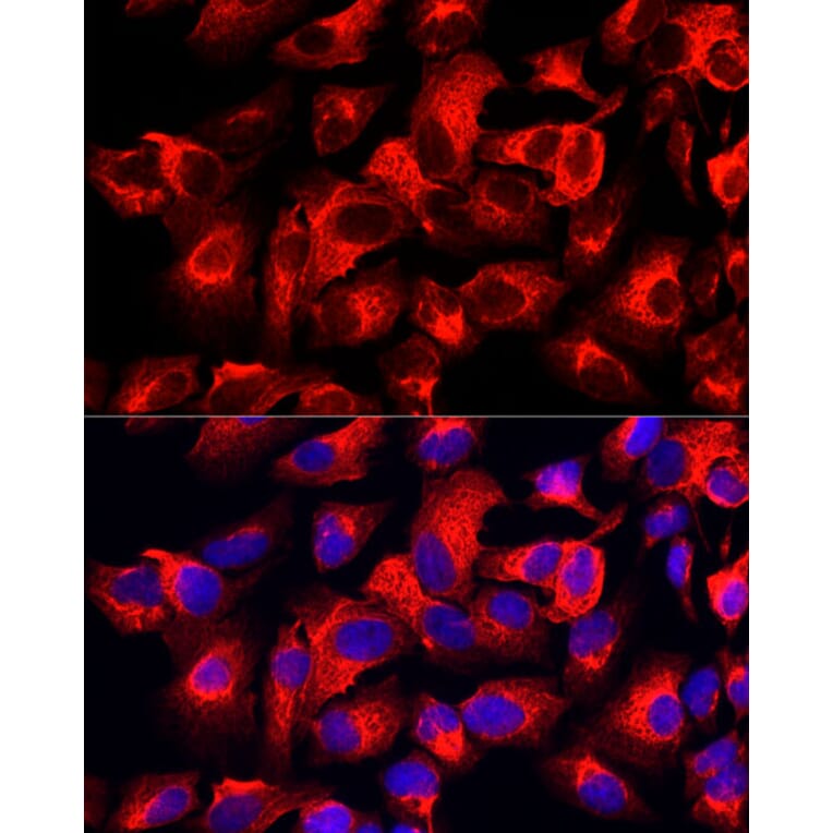 Immunofluorescence - Anti-Cytokeratin 17 Antibody [ARC0271] (A307949) - Antibodies.com