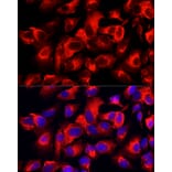 Immunofluorescence - Anti-Cytokeratin 17 Antibody [ARC0271] (A307949) - Antibodies.com