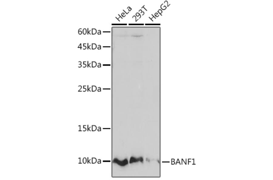 Western Blot - Anti-BANF1/BAF Antibody [ARC2085] (A307950) - Antibodies.com