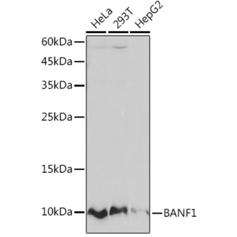 Western Blot - Anti-BANF1/BAF Antibody [ARC2085] (A307950) - Antibodies.com