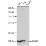 Western Blot - Anti-BANF1/BAF Antibody [ARC2085] (A307950) - Antibodies.com