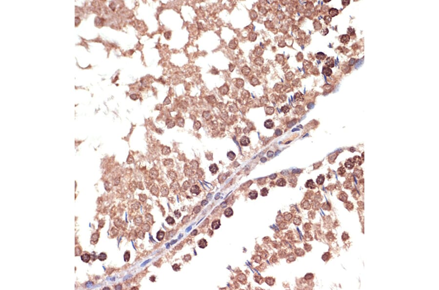 Immunohistochemistry - Anti-BANF1/BAF Antibody [ARC2085] (A307950) - Antibodies.com