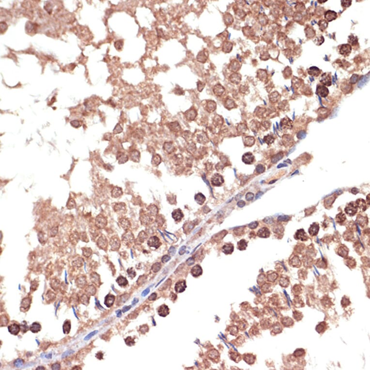 Immunohistochemistry - Anti-BANF1/BAF Antibody [ARC2085] (A307950) - Antibodies.com