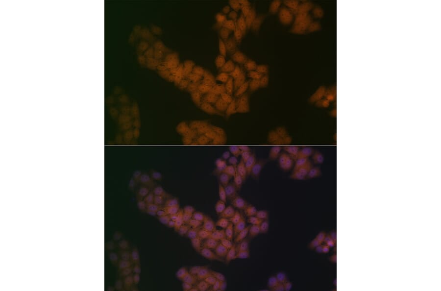 Immunofluorescence - Anti-BANF1/BAF Antibody [ARC2085] (A307950) - Antibodies.com