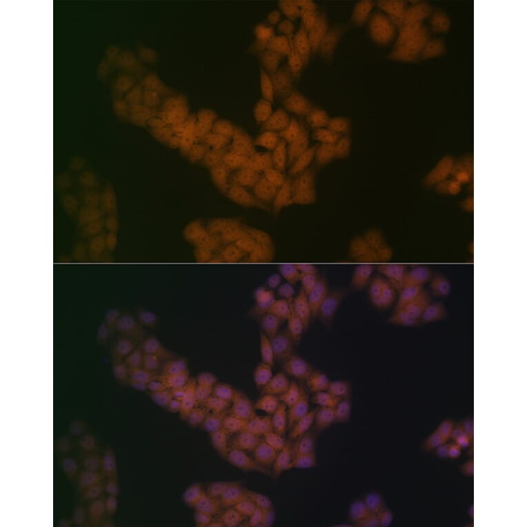 Immunofluorescence - Anti-BANF1/BAF Antibody [ARC2085] (A307950) - Antibodies.com
