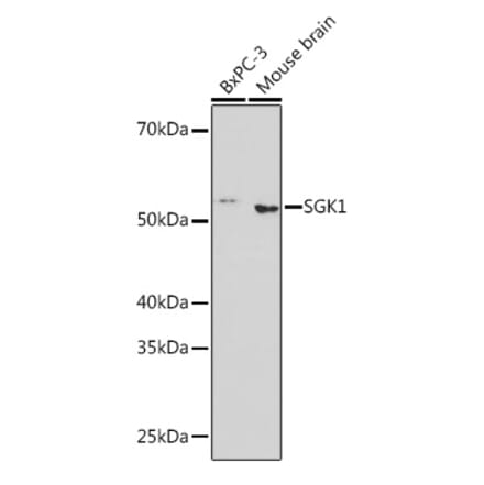 Western Blot - Anti-SGK1 Antibody [ARC0868] (A307951) - Antibodies.com