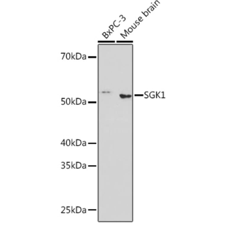 Western Blot - Anti-SGK1 Antibody [ARC0868] (A307951) - Antibodies.com