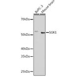 Western Blot - Anti-SGK1 Antibody [ARC0868] (A307951) - Antibodies.com