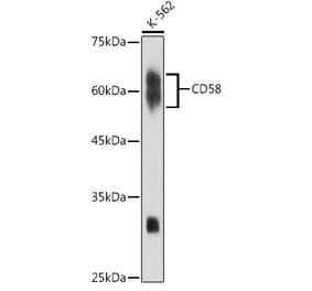 Western Blot - Anti-CD58 Antibody [ARC2540] (A307952) - Antibodies.com