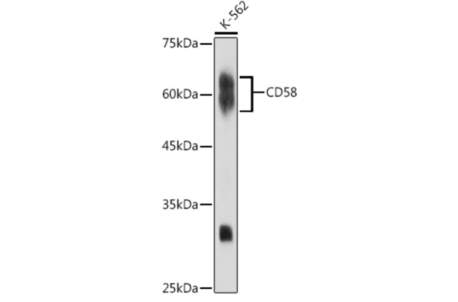 Western Blot - Anti-CD58 Antibody [ARC2540] (A307952) - Antibodies.com