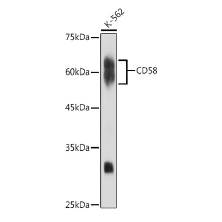 Western Blot - Anti-CD58 Antibody [ARC2540] (A307952) - Antibodies.com