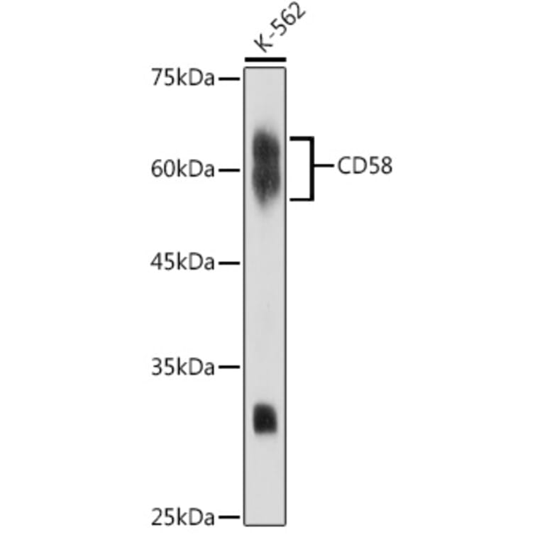 Western Blot - Anti-CD58 Antibody [ARC2540] (A307952) - Antibodies.com