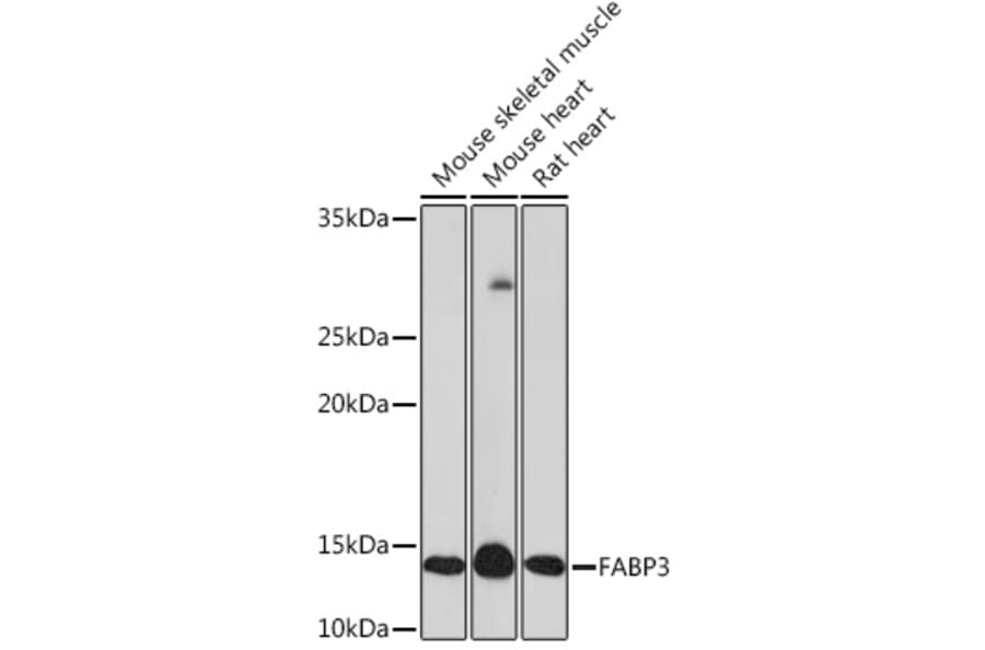 Western Blot - Anti-H-FABP Antibody [ARC1302] (A307954) - Antibodies.com
