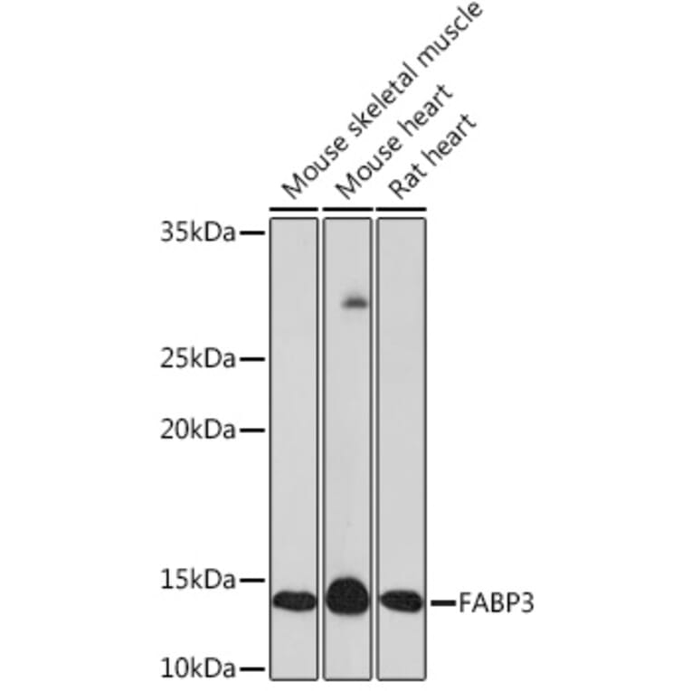 Western Blot - Anti-H-FABP Antibody [ARC1302] (A307954) - Antibodies.com