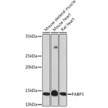 Western Blot - Anti-H-FABP Antibody [ARC1302] (A307954) - Antibodies.com