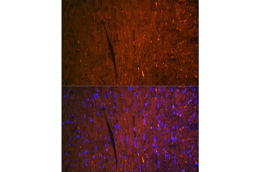 Immunofluorescence - Anti-H-FABP Antibody [ARC1302] (A307954) - Antibodies.com