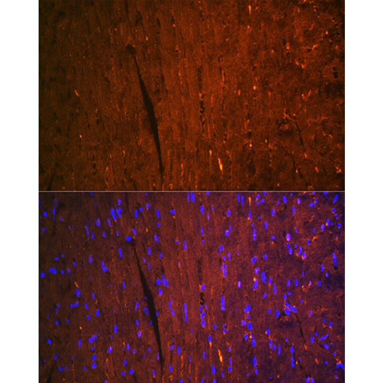 Immunofluorescence - Anti-H-FABP Antibody [ARC1302] (A307954) - Antibodies.com