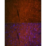 Immunofluorescence - Anti-H-FABP Antibody [ARC1302] (A307954) - Antibodies.com