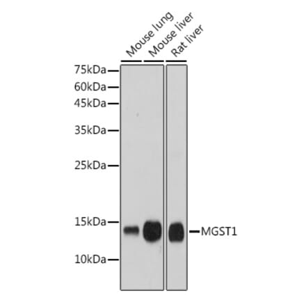 Western Blot - Anti-MGST1 Antibody [ARC2550] (A307955) - Antibodies.com