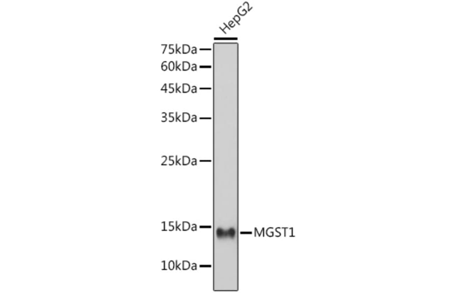 Western Blot - Anti-MGST1 Antibody [ARC2550] (A307955) - Antibodies.com