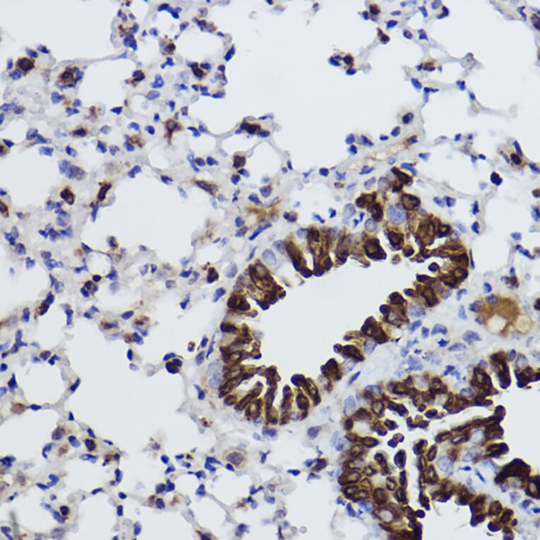 Immunohistochemistry - Anti-MGST1 Antibody [ARC2550] (A307955) - Antibodies.com