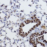 Immunohistochemistry - Anti-MGST1 Antibody [ARC2550] (A307955) - Antibodies.com