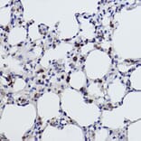 Immunohistochemistry - Anti-MGST1 Antibody [ARC2550] (A307955) - Antibodies.com