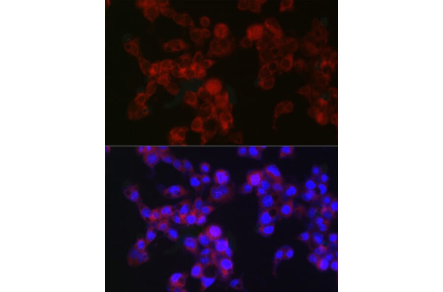 Immunofluorescence - Anti-MGST1 Antibody [ARC2550] (A307955) - Antibodies.com