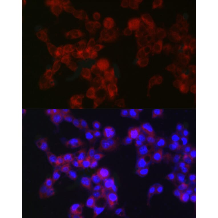 Immunofluorescence - Anti-MGST1 Antibody [ARC2550] (A307955) - Antibodies.com