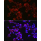 Immunofluorescence - Anti-MGST1 Antibody [ARC2550] (A307955) - Antibodies.com