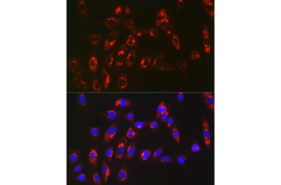 Immunofluorescence - Anti-MGST1 Antibody [ARC2550] (A307955) - Antibodies.com