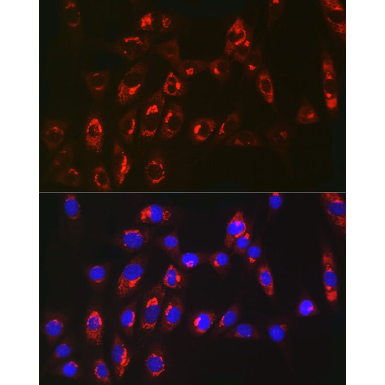 Immunofluorescence - Anti-MGST1 Antibody [ARC2550] (A307955) - Antibodies.com