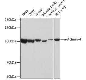 Western Blot - Anti-alpha Actinin 4 Antibody [ARC1959] (A307957) - Antibodies.com