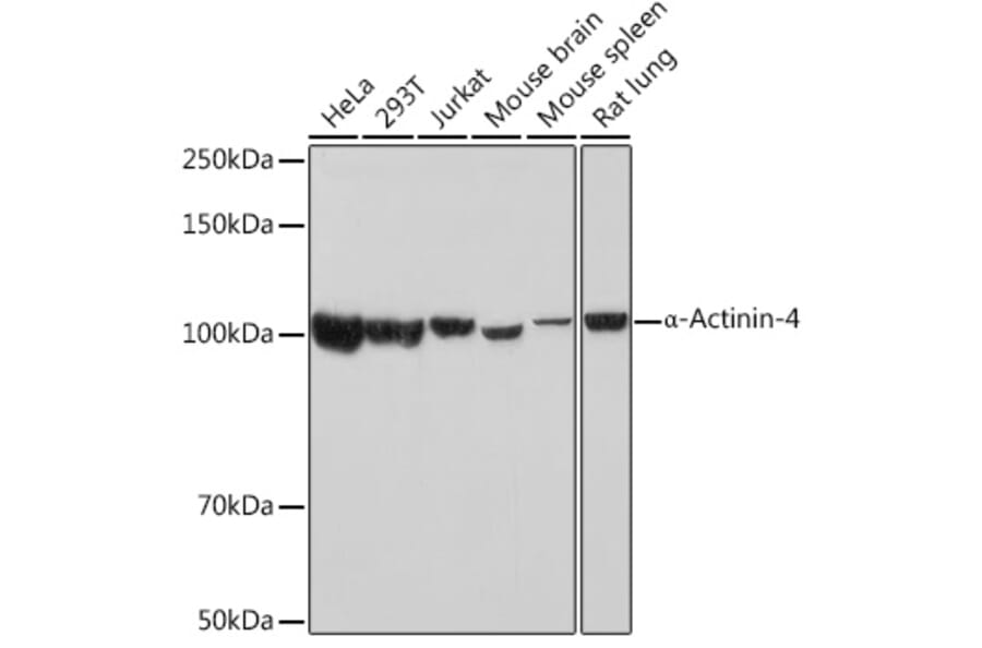 Western Blot - Anti-alpha Actinin 4 Antibody [ARC1959] (A307957) - Antibodies.com