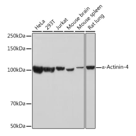 Western Blot - Anti-alpha Actinin 4 Antibody [ARC1959] (A307957) - Antibodies.com