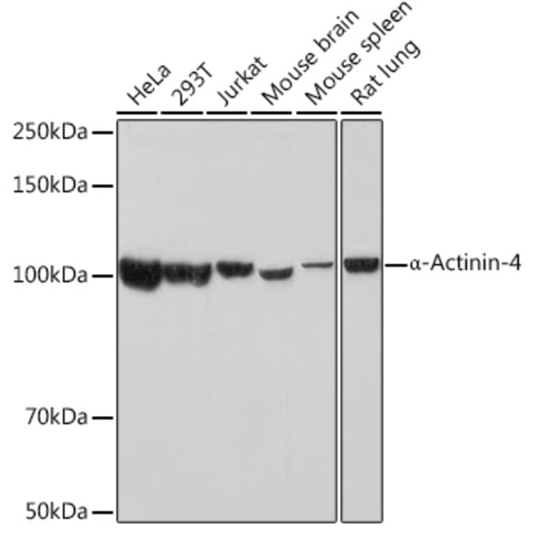 Western Blot - Anti-alpha Actinin 4 Antibody [ARC1959] (A307957) - Antibodies.com