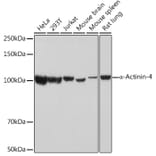 Western Blot - Anti-alpha Actinin 4 Antibody [ARC1959] (A307957) - Antibodies.com