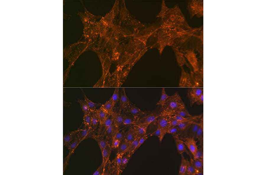 Immunofluorescence - Anti-alpha Actinin 4 Antibody [ARC1959] (A307957) - Antibodies.com