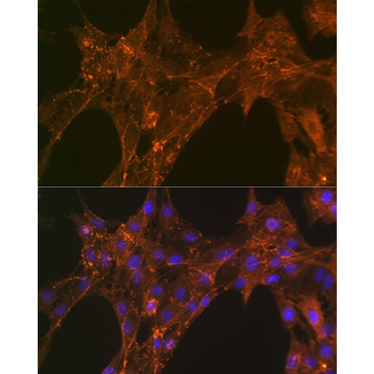 Immunofluorescence - Anti-alpha Actinin 4 Antibody [ARC1959] (A307957) - Antibodies.com