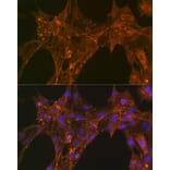 Immunofluorescence - Anti-alpha Actinin 4 Antibody [ARC1959] (A307957) - Antibodies.com