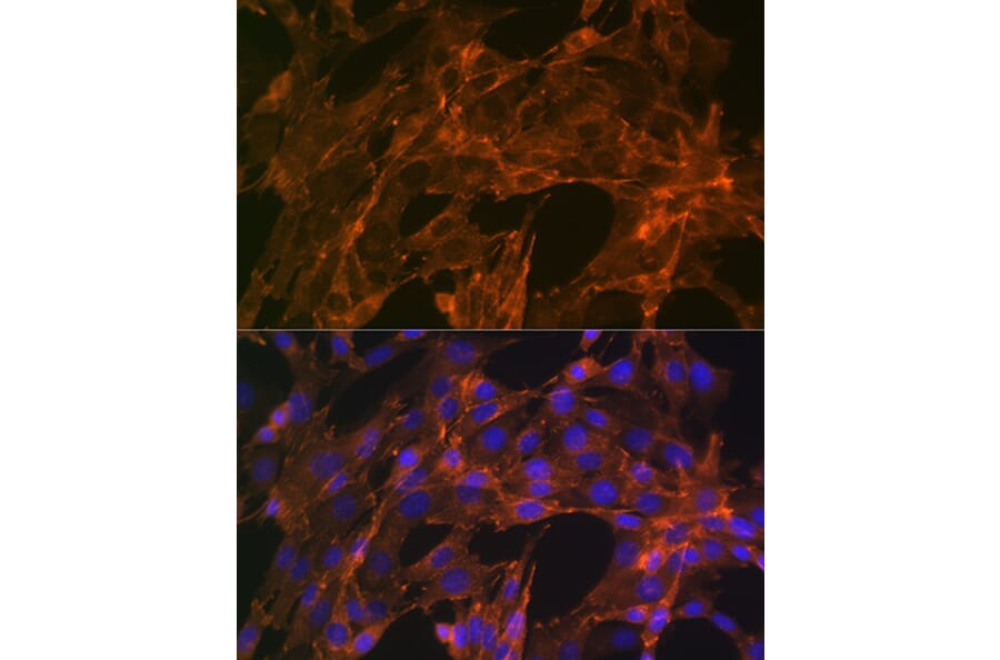 Immunofluorescence - Anti-alpha Actinin 4 Antibody [ARC1959] (A307957) - Antibodies.com