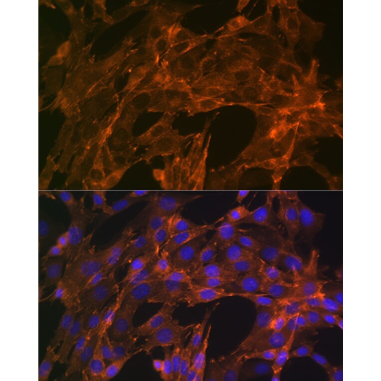 Immunofluorescence - Anti-alpha Actinin 4 Antibody [ARC1959] (A307957) - Antibodies.com