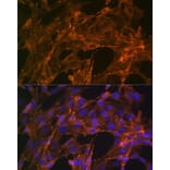 Immunofluorescence - Anti-alpha Actinin 4 Antibody [ARC1959] (A307957) - Antibodies.com