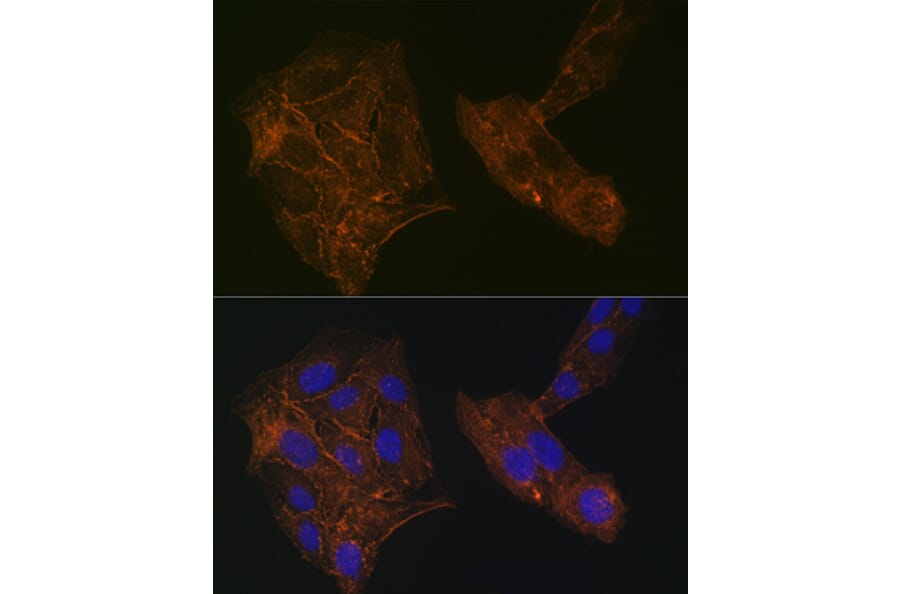 Immunofluorescence - Anti-alpha Actinin 4 Antibody [ARC1959] (A307957) - Antibodies.com