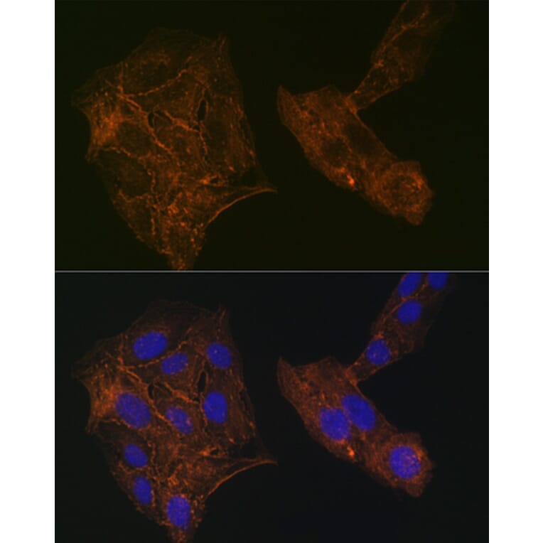 Immunofluorescence - Anti-alpha Actinin 4 Antibody [ARC1959] (A307957) - Antibodies.com
