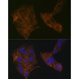 Immunofluorescence - Anti-alpha Actinin 4 Antibody [ARC1959] (A307957) - Antibodies.com