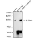 Western Blot - Anti-alpha Actinin 4 Antibody [ARC1959] (A307957) - Antibodies.com